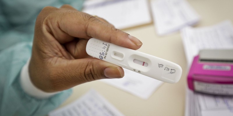 Distrito Federal tem 23 novos postos de testagem para covid-19
