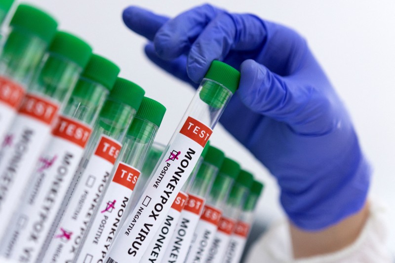 Fiocruz produz insumos para diagnóstico da varíola dos macacos