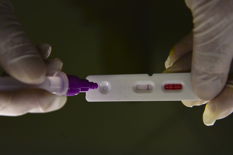 Pesquisadores identificam método capaz de prever gravidade da covid-19