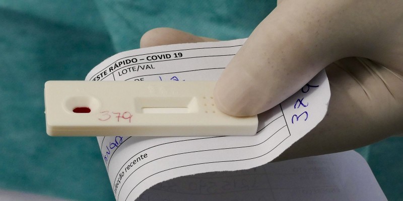 Anvisa aprova novo teste de diagnóstico para covid-19 