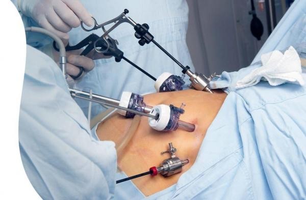 Vereador solicita equipamento de vídeolaparoscopia à deputado estadual