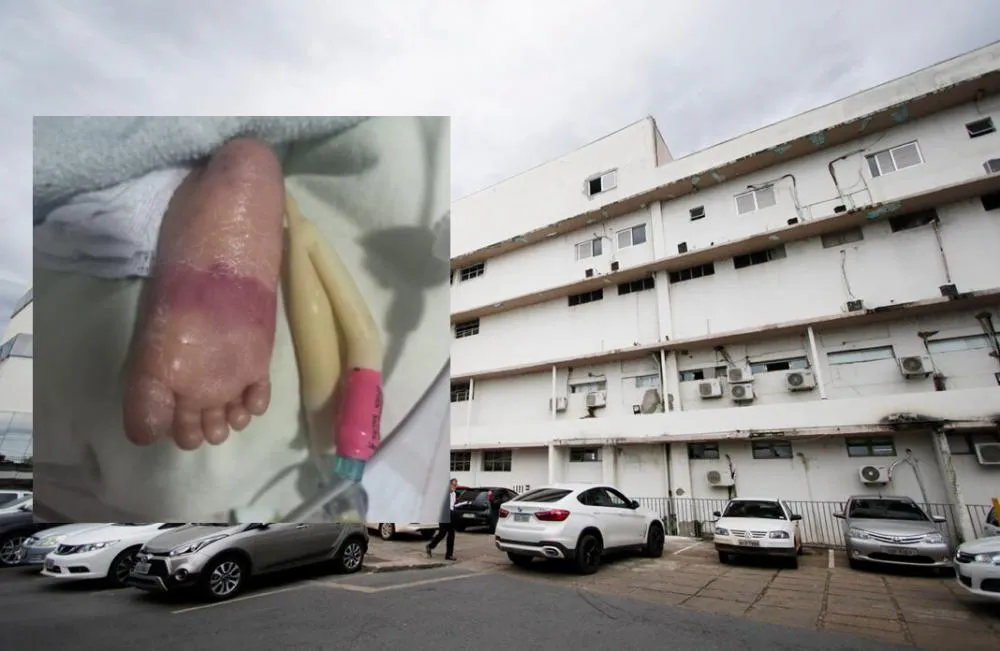 Recém-nascido morre no Santa Helena com queimaduras e lesões em Cuiabá