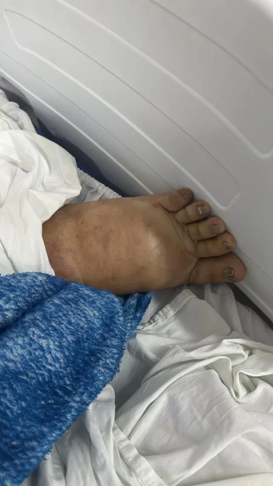 Paciente com dengue hemorrágica que está internado em UPA precisa ser transferido para hospital; família pede ajuda