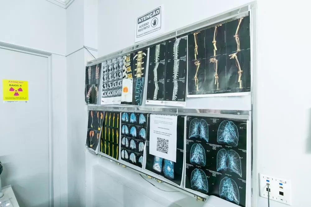 Cuiabá instala ressonância magnética de última geração no São Benedito