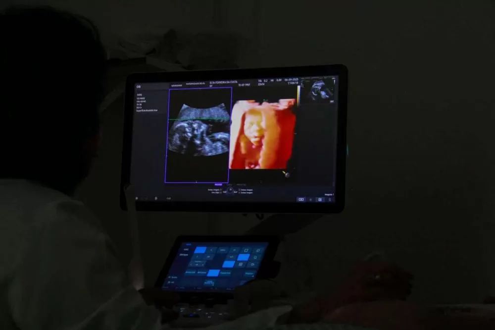 Ultrassom Morfológico garante acompanhamento detalhado da gestação e do bebê em Várzea Grande