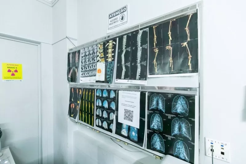 Saúde de Cuiabá oferece mamografia e ressonância para mulheres