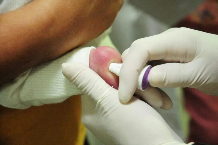 MT Hemocentro atende 599 pacientes com a doença falciforme 